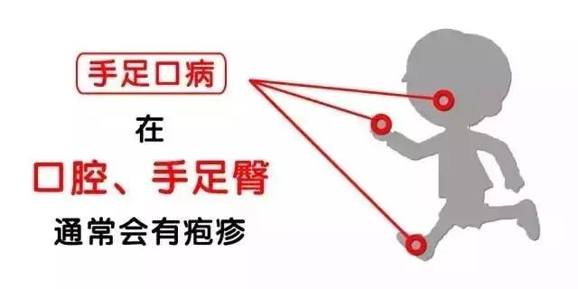 200505ls7936yjousau63i.png